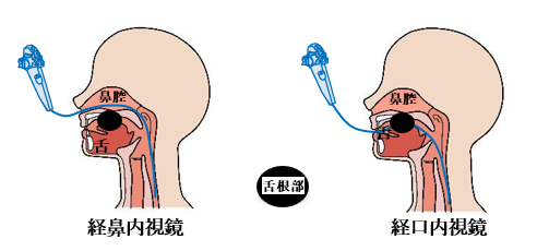 経鼻内視鏡